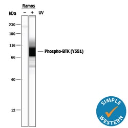 Phospho-BTK (Y551) Mouse anti-Human, Clone: 797837, R D Systems 25&mu;g;