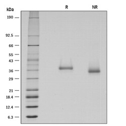 R D Systems Recombinant Human BTN1A1/Butyrophilin Protein 50 &mu;g | Buy Online | R&amp;D Systems&trade; | Fisher Scientific