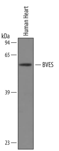 Human BVES Antibody, R D Systems 100&mu;g; Unlabeled:Antibodies, Polyclonal