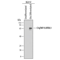 Human Otolin-1 Antibody, R D Systems 100ug; Unlabeled:Antibodies, Monoclonal