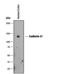 Human Cadherin-17 Antibody, R D Systems 100&mu;g; Unlabeled:Antibodies,