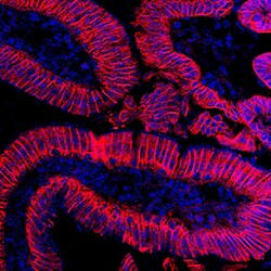 Mouse Cadherin-17 Antibody, R D Systems:Antibodies:Primary Antibodies