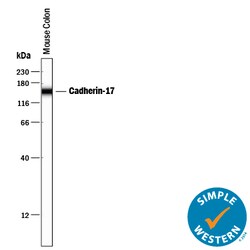 Mouse Cadherin-17 Antibody, R D Systems:Antibodies:Primary Antibodies