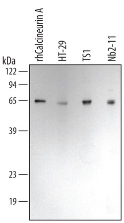 Human/Mouse/Rat Calcineurin A Antibody, R D Systems 25&mu;g; Unlabeled:Antibodies,