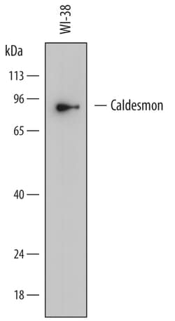 Human Caldesmon/CALD1 Antibody, R D Systems 25&mu;g; Unlabeled:Antibodies,
