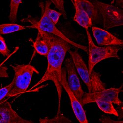 Human Calponin 1 Antibody, R D Systems 25&mu;g; Unlabeled:Antibodies, Monoclonal