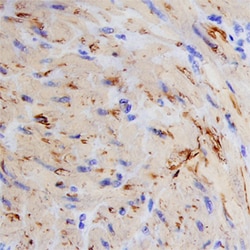 Human Calponin 1 Antibody, R D Systems 25&mu;g; Unlabeled:Antibodies, Monoclonal
