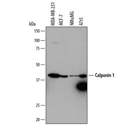 Human Calponin 1 Antibody, R D Systems 25&mu;g; Unlabeled:Antibodies, Monoclonal