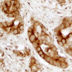 Human/Mouse/Rat Calreticulin Antibody, R D Systems 100ug; Unlabeled:Antibodies,