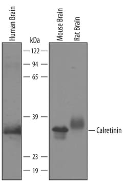 Human/Mouse/Rat Calretinin Antibody, R D Systems 100&mu;g; Unlabeled:Antibodies,