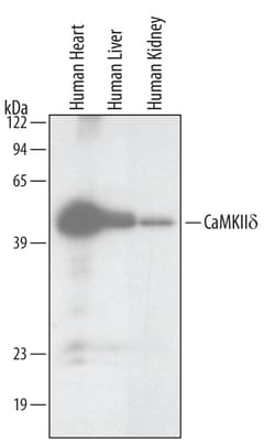 Human CaM Kinase II delta Antibody, R D Systems 100ug; Unlabeled:Antibodies,