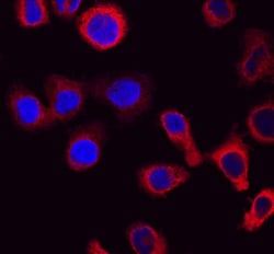 Human CapG Antibody, R D Systems 25&mu;g; Unlabeled:Antibodies, Polyclonal