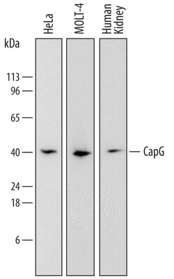 Human CapG Antibody, R D Systems 25&mu;g; Unlabeled:Antibodies, Polyclonal