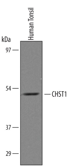 Human Carbohydrate Sulfotransferase 1/CHST1 Antibody, R D Systems 25&mu;g;