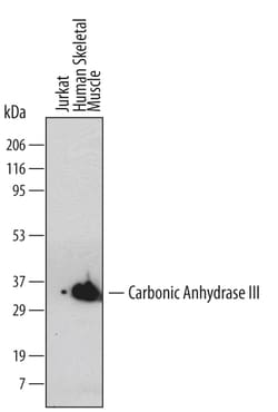 Human Carbonic Anhydrase III/CA3 Antibody, R D Systems 100ug; Unlabeled:Antibodies,