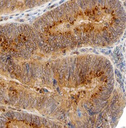 Human Carbonic Anhydrase IX/CA9 Antibody, R D Systems 25&mu;g; Unlabeled:Antibodies,