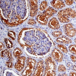 Human Carbonic Anhydrase VB/CA5B Antibody, R D Systems 100&mu;g; Unlabeled:Antibodies,
