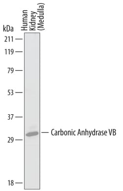 Human Carbonic Anhydrase VB/CA5B Antibody, R D Systems 100&mu;g; Unlabeled:Antibodies,