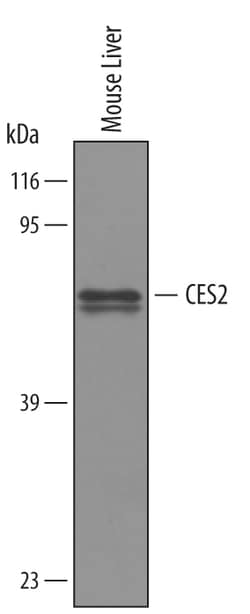 Mouse Carboxylesterase 2/CES2 Antibody, R D Systems 100&mu;g; Unlabeled:Antibodies,