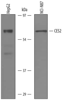 Human Carboxylesterase 2/CES2 Antibody, R D Systems 25&mu;g; Unlabeled:Antibodies,