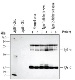 Carboxymethyl Lysine Antibody, R D Systems 100ug; Unlabeled:Antibodies,