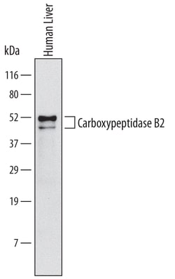 Human Carboxypeptidase B2/CPB2 Antibody, R D Systems 100ug; Unlabeled:Antibodies,