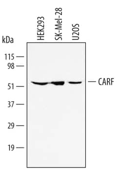 Human CARF Antibody, R D Systems 25&mu;g; Unlabeled:Antibodies, Polyclonal