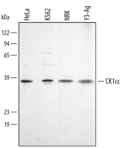 Human/Mouse/Rat Casein Kinase 1 alpha Antibody, R D Systems 25&mu;g; Unlabeled:Antibodies,