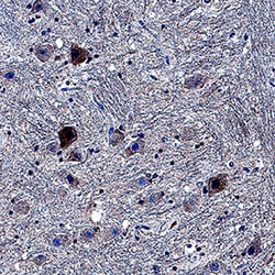 Human/Mouse/Rat Casein Kinase 1 gamma Antibody, R D Systems 100&mu;g; Unlabeled:Antibodies,