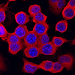 Human/Mouse/Rat Casein Kinase 2 beta Antibody, R D Systems 25 &mu;g | Buy Online | R&D Systems | Fisher Scientific