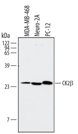 Human/Mouse/Rat Casein Kinase 2 beta Antibody, R D Systems 25 &mu;g | Buy Online | R&D Systems | Fisher Scientific
