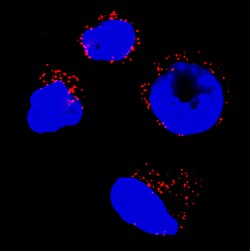 Human Catalase Antibody, R D Systems 25&mu;g; Unlabeled:Antibodies, Monoclonal