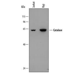 Human Catalase Antibody, R D Systems 25&mu;g; Unlabeled:Antibodies, Monoclonal