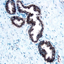 Human Cathepsin A/Lysosomal Carboxypeptidase A Antibody, R D Systems 25&mu;g;