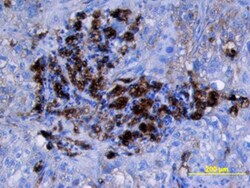 Human Cathepsin D Antibody, R D Systems 25&mu;g; Unlabeled:Antibodies,