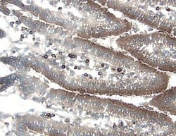 Mouse Cathepsin D Antibody, R D Systems 100&mu;g; Unlabeled:Antibodies,