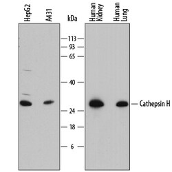 Human Cathepsin H Antibody, R D Systems 25&mu;g; Unlabeled:Antibodies,
