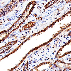 Human Cathepsin L Antibody, R&D Systems&trade;