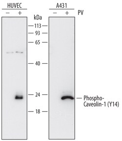 Human Phospho-Caveolin-1 (Y14) Antibody, R D Systems 25&mu;g; Unlabeled:Antibodies,