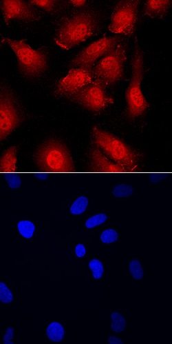 Human/Mouse CBFB Antibody, R D Systems 100 &mu;g | Buy Online | R&D Systems | Fisher Scientific