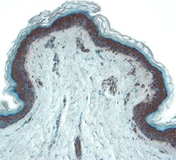 Human CCL11/Eotaxin Antibody, R D Systems 100&mu;g; Unlabeled:Antibodies,
