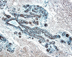 Human CCL2/JE/MCP-1 Antibody, R D Systems 500&mu;g; Unlabeled:Anticorps,