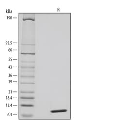 R D Systems Recombinant Human CCL20/MIP-3 alpha Protein Lyophilized from a 0.2&mu;m filtered solution in Acetonitrile and TFA. | Buy Online | R&amp;D Systems&trade; | Fisher Scientific