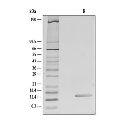 R D Systems Recombinant Human CCL28 Protein Lyophilized from a 0.2&mu;m filtered solution in PBS with BSA as a carrier protein. | Buy Online | R&amp;D Systems&trade; | Fisher Scientific
