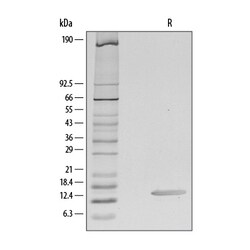 R D Systems Recombinant Human CCL28 Protein Lyophilized from a 0.2&mu;m filtered solution in PBS. | Buy Online | R&amp;D Systems&trade; | Fisher Scientific