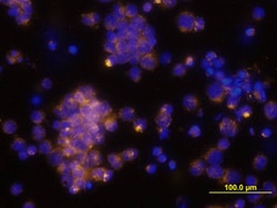 Human CCL4/MIP-1 beta Antibody, R D Systems 100&mu;g; Unlabeled:Antibodies,