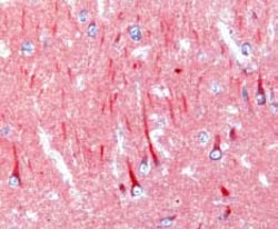 Human CCL4/MIP-1 beta Antibody, R D Systems 100&mu;g; Unlabeled:Antibodies,