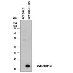 Mouse CCL4/MIP-1 beta Antibody, R D Systems 25&mu;g; Unlabeled:Antibodies,