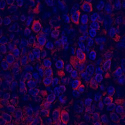 Human CCL5/RANTES Antibody, R D Systems 25&mu;g; Unlabeled:Antibodies,