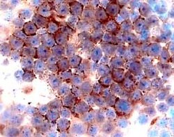 Human CCR3 Antibody, R D Systems 100ug; Unlabeled:Antibodies, Monoclonal